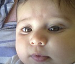 Obesidad: la otra cara de la malnutrición